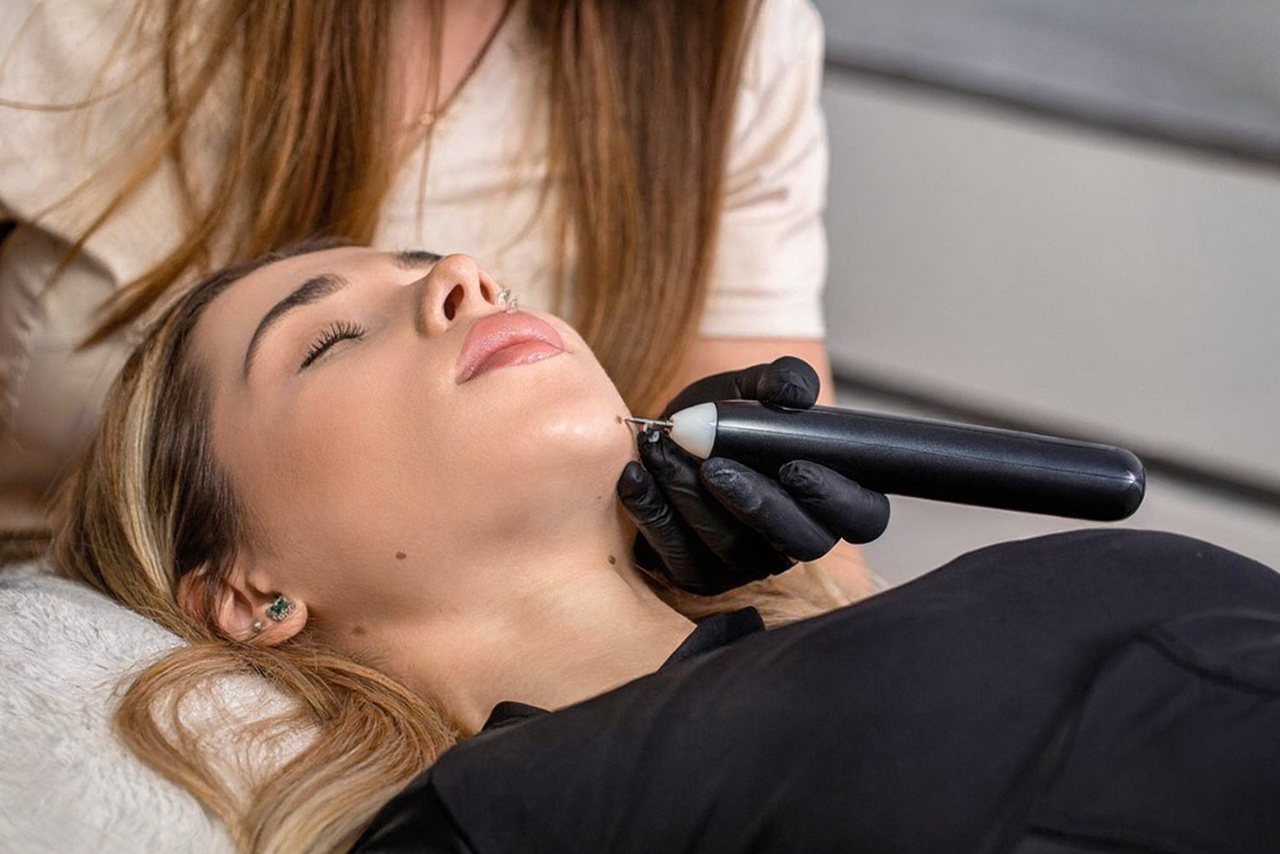sdfg Laser vs. chirurgické odstranění bradavic. Která metoda je rychlejší, šetrnější a účinnější? obrázek 4